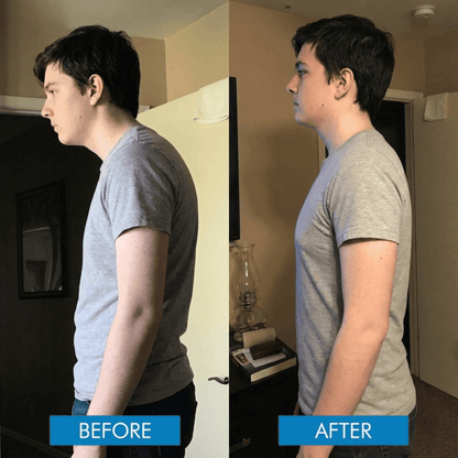 Revitta Instant Posture Corrector