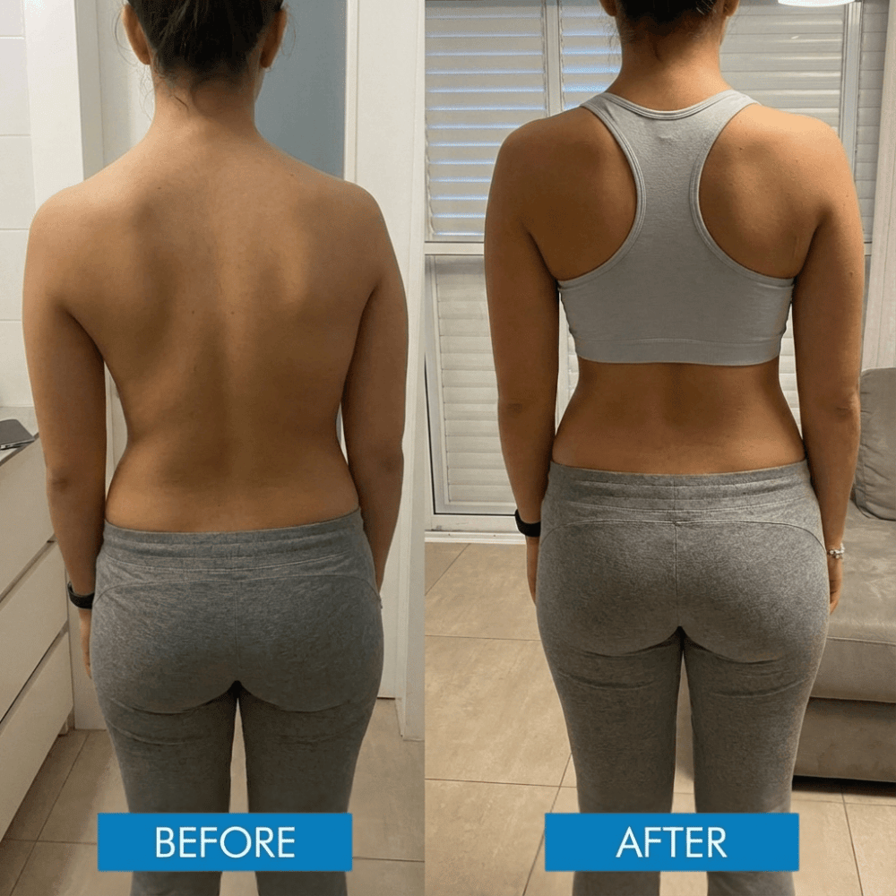 Revitta Instant Posture Corrector